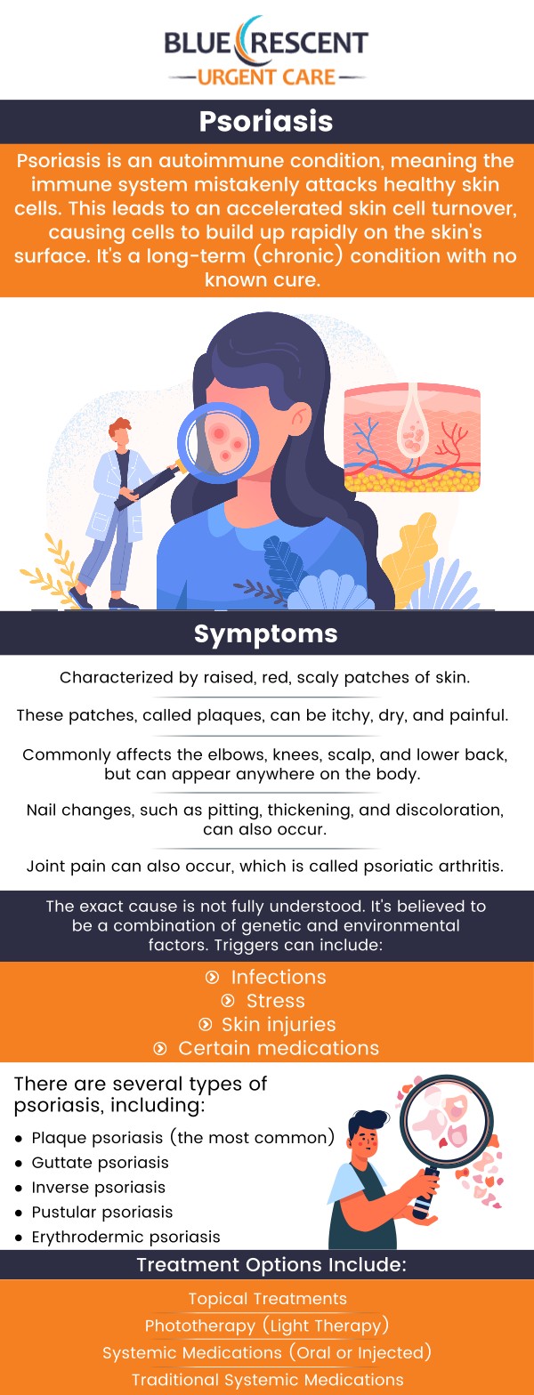 Several treatment options can relieve psoriasis symptoms. Visit Blue Crescent Urgent Care Walk-In Clinic to get specialized and comprehensive care. For more information, contact us today or book an appointment online. We are conveniently located at 3809 42nd Ave S Suite 100, Minneapolis, MN 55406. We serve patients from Minneapolis MN, Mendota MN, Edina MN, Lauderdale MN, Golden Valley MN, St Paul MN, and BEYOND! Several treatment options can relieve psoriasis symptoms. Visit Blue Crescent Urgent Care Walk-In Clinic to get specialized and comprehensive care. For more information, contact us today or book an appointment online. We are conveniently located at 3809 42nd Ave S Suite 100, Minneapolis, MN 55406. We serve patients from Minneapolis MN, Mendota MN, Edina MN, Lauderdale MN, Golden Valley MN, St Paul MN, and BEYOND!