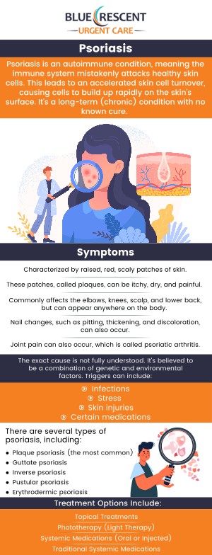 Several treatment options can relieve psoriasis symptoms. Visit Blue Crescent Urgent Care Walk-In Clinic to get specialized and comprehensive care. For more information, contact us today or book an appointment online. We are conveniently located at 3809 42nd Ave S Suite 100, Minneapolis, MN 55406. We serve patients from Minneapolis MN, Mendota MN, Edina MN, Lauderdale MN, Golden Valley MN, St Paul MN, and BEYOND! Several treatment options can relieve psoriasis symptoms. Visit Blue Crescent Urgent Care Walk-In Clinic to get specialized and comprehensive care. For more information, contact us today or book an appointment online. We are conveniently located at 3809 42nd Ave S Suite 100, Minneapolis, MN 55406. We serve patients from Minneapolis MN, Mendota MN, Edina MN, Lauderdale MN, Golden Valley MN, St Paul MN, and BEYOND!